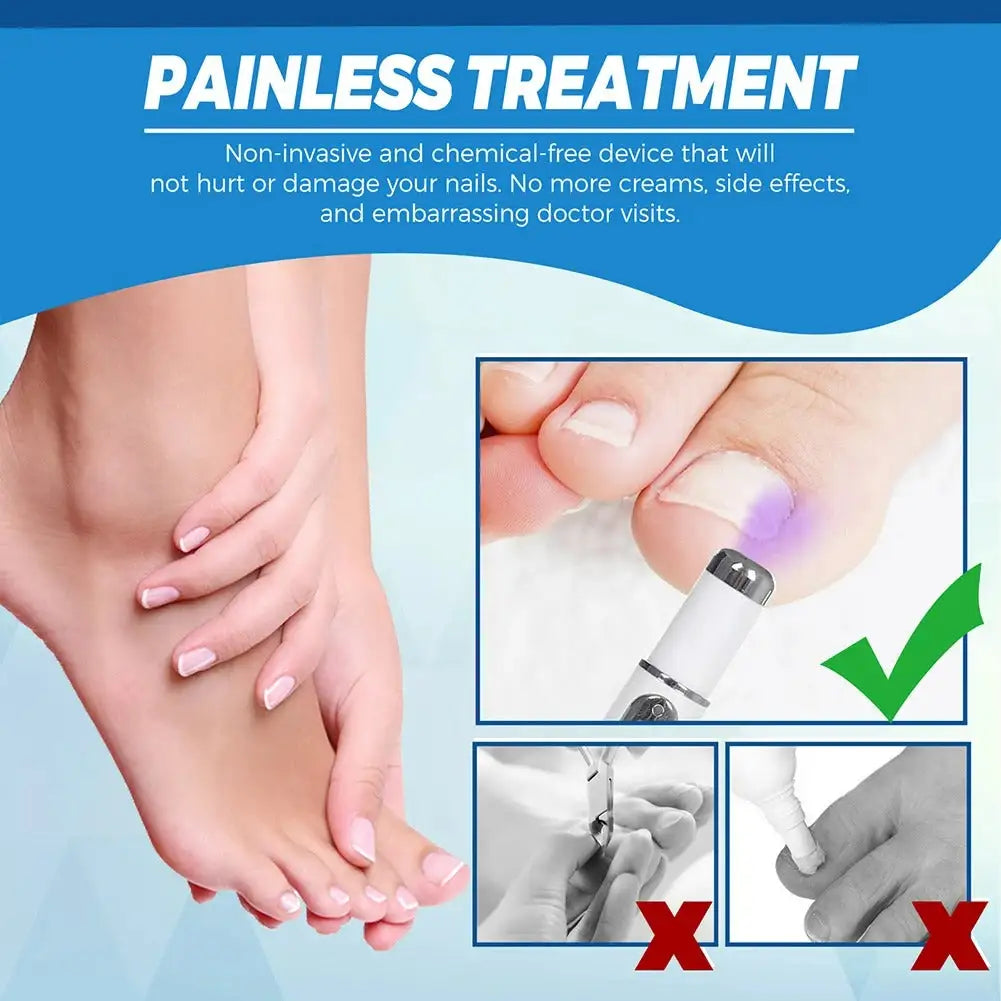 Antifungal Laser Device